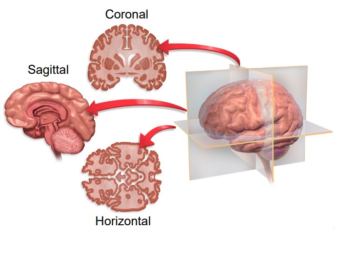 Cartoon illustration of the brain showing the three different orientations of the brain