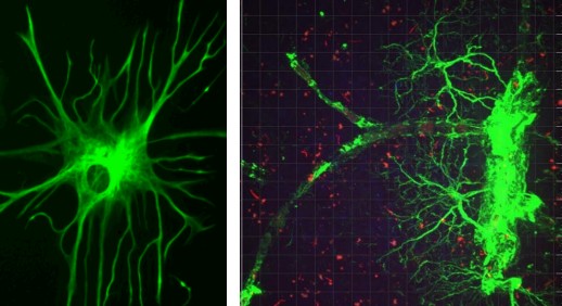 Images of stained astrocytes