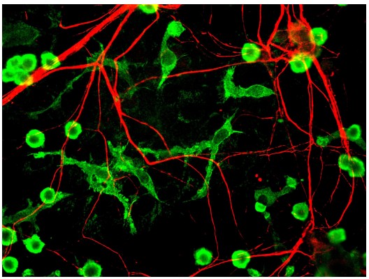 Image of the network of microglia and neurons