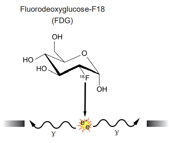 Chemical structure of Fluorodeoxyglucose-F18