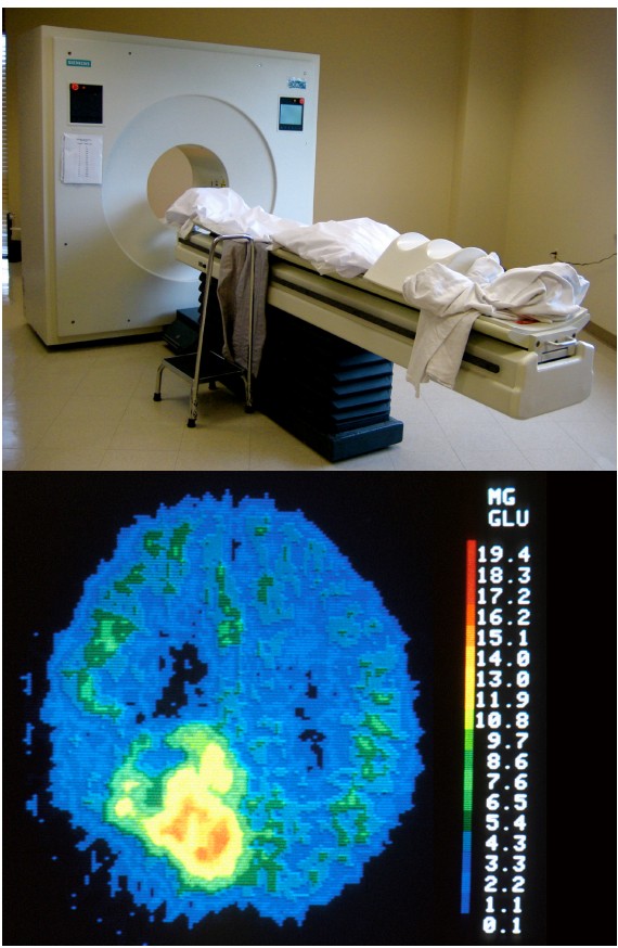 PET scan machine and the image it produces