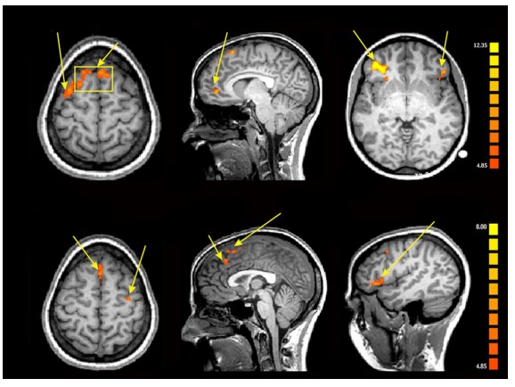 Results of the fMRI
