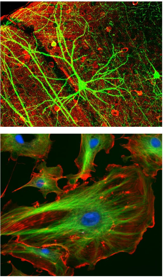 Neurons at different magnifications