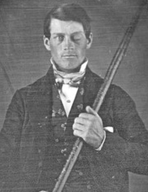 A photo of Phineas Gage