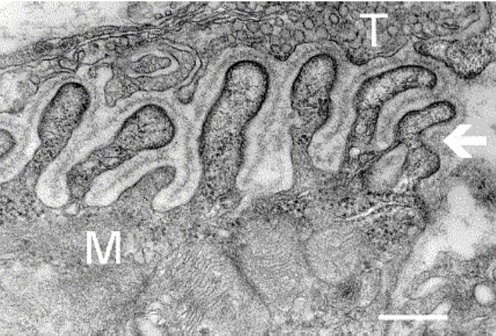 Image of a neuromuscular junction