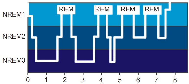 Graph showing time spent in each stage of sleep throughout the night