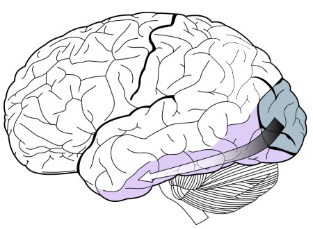 location of the inferotemporal cortex in the brain