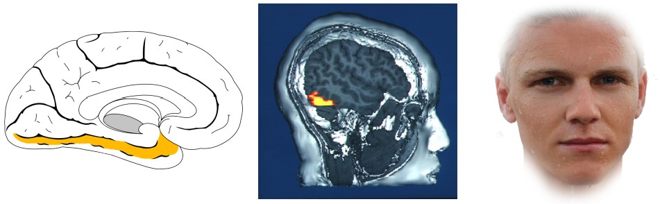 location of the inferotemporal cortex, location of the fusiform gyrus within the IT, and an image of a face